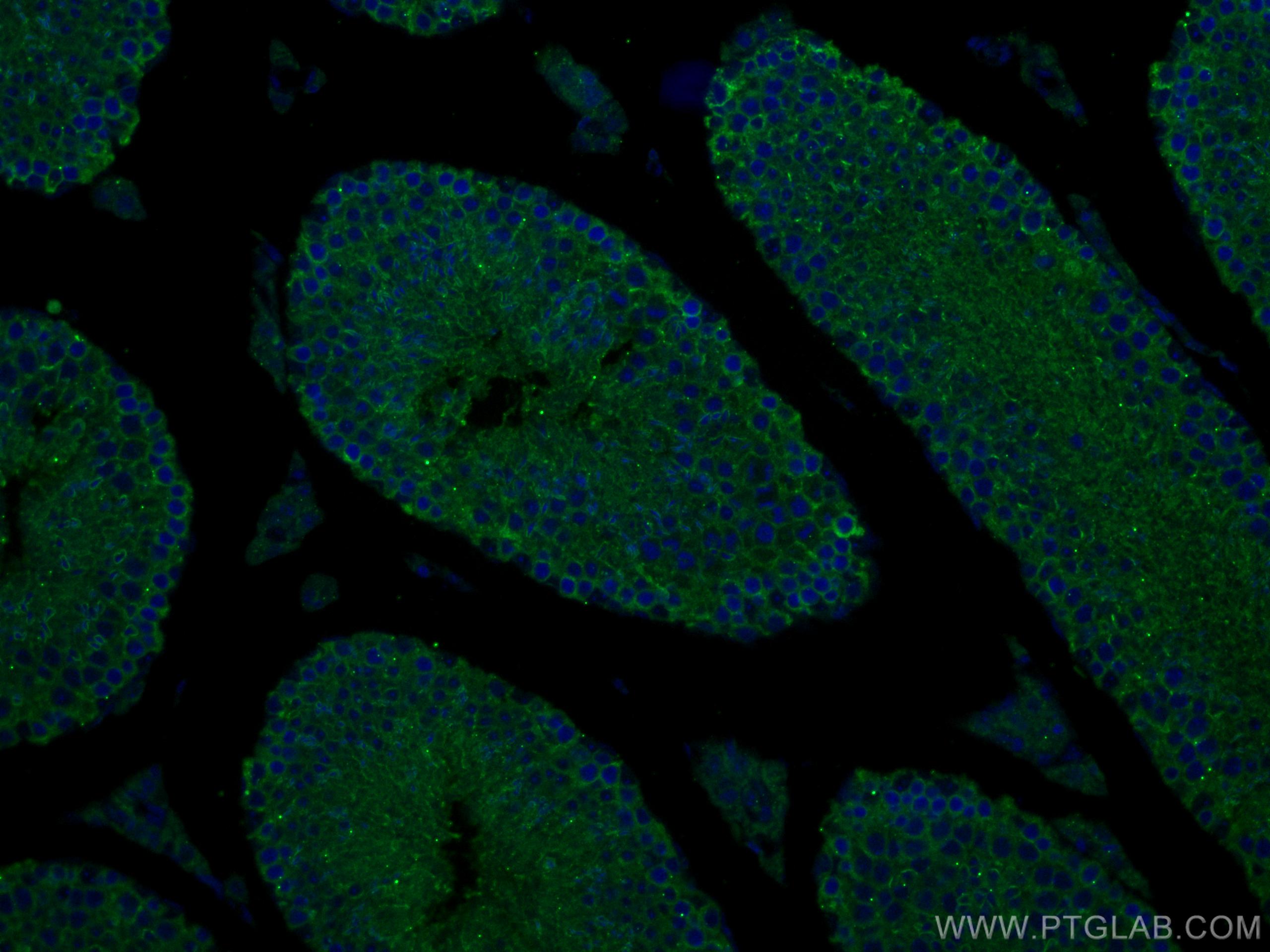 Immunofluorescence (IF) / fluorescent staining of mouse testis tissue using SLC26A8 Polyclonal antibody (12776-1-AP)