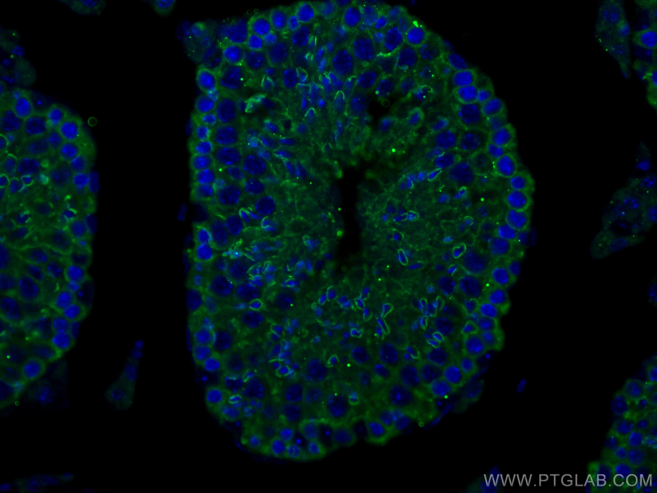 Immunofluorescence (IF) / fluorescent staining of mouse testis tissue using SLC26A8 Polyclonal antibody (12776-1-AP)