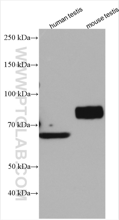 Western Blot (WB) analysis of various lysates using SLC26A8 Polyclonal antibody (12776-1-AP)