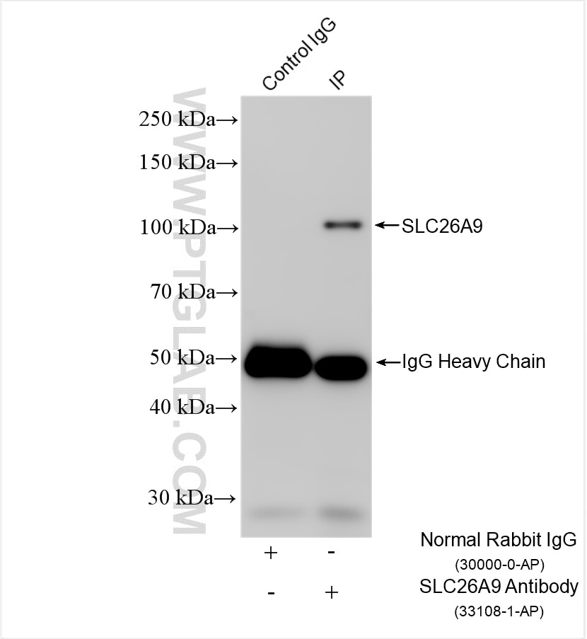 Immunoprecipitation (IP) experiment of BxPC-3 cells using SLC26A9 Polyclonal antibody (33108-1-AP)