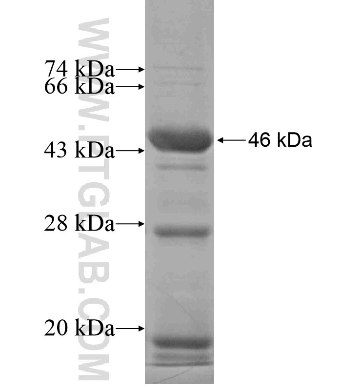 SLC26A9 fusion protein Ag16622 SDS-PAGE