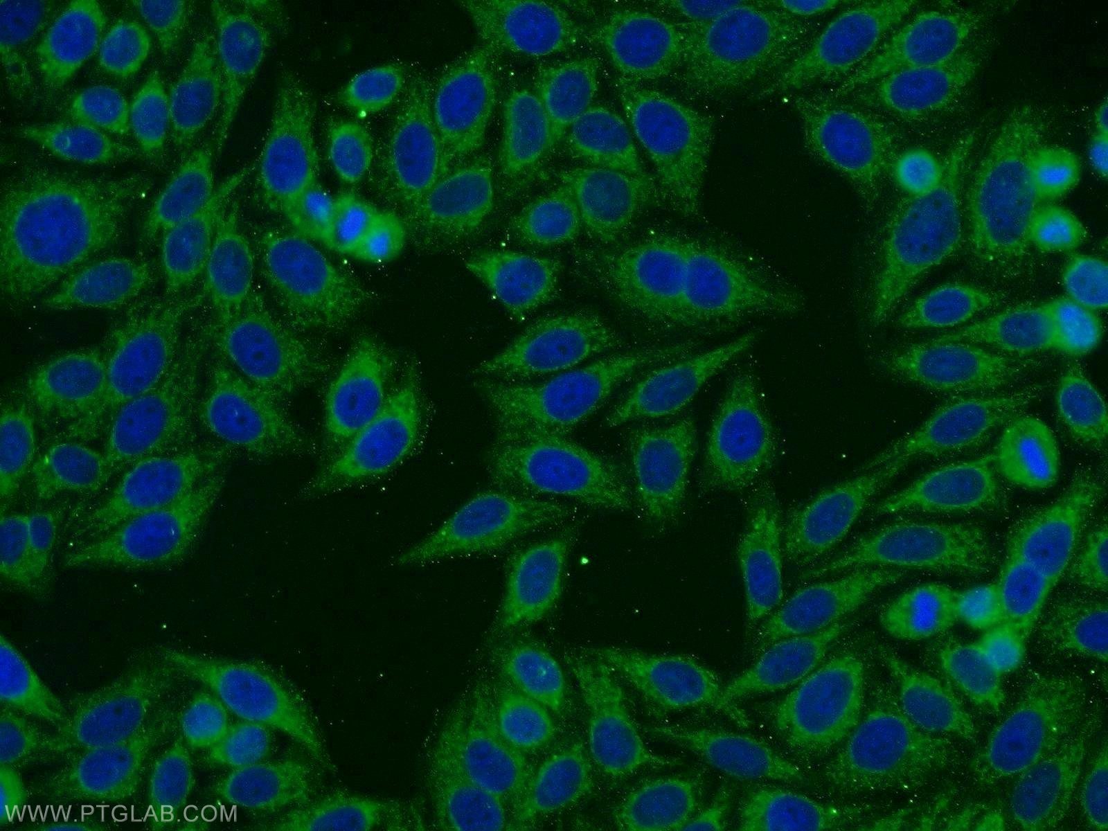 Immunofluorescence (IF) / fluorescent staining of HepG2 cells using FATP2 Polyclonal antibody (14048-1-AP)