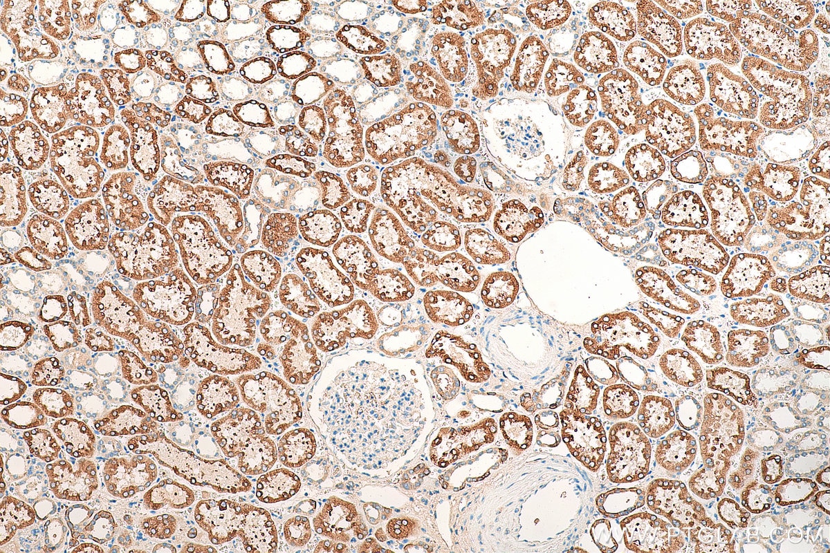Immunohistochemistry (IHC) staining of human kidney tissue using FATP2 Polyclonal antibody (14048-1-AP)