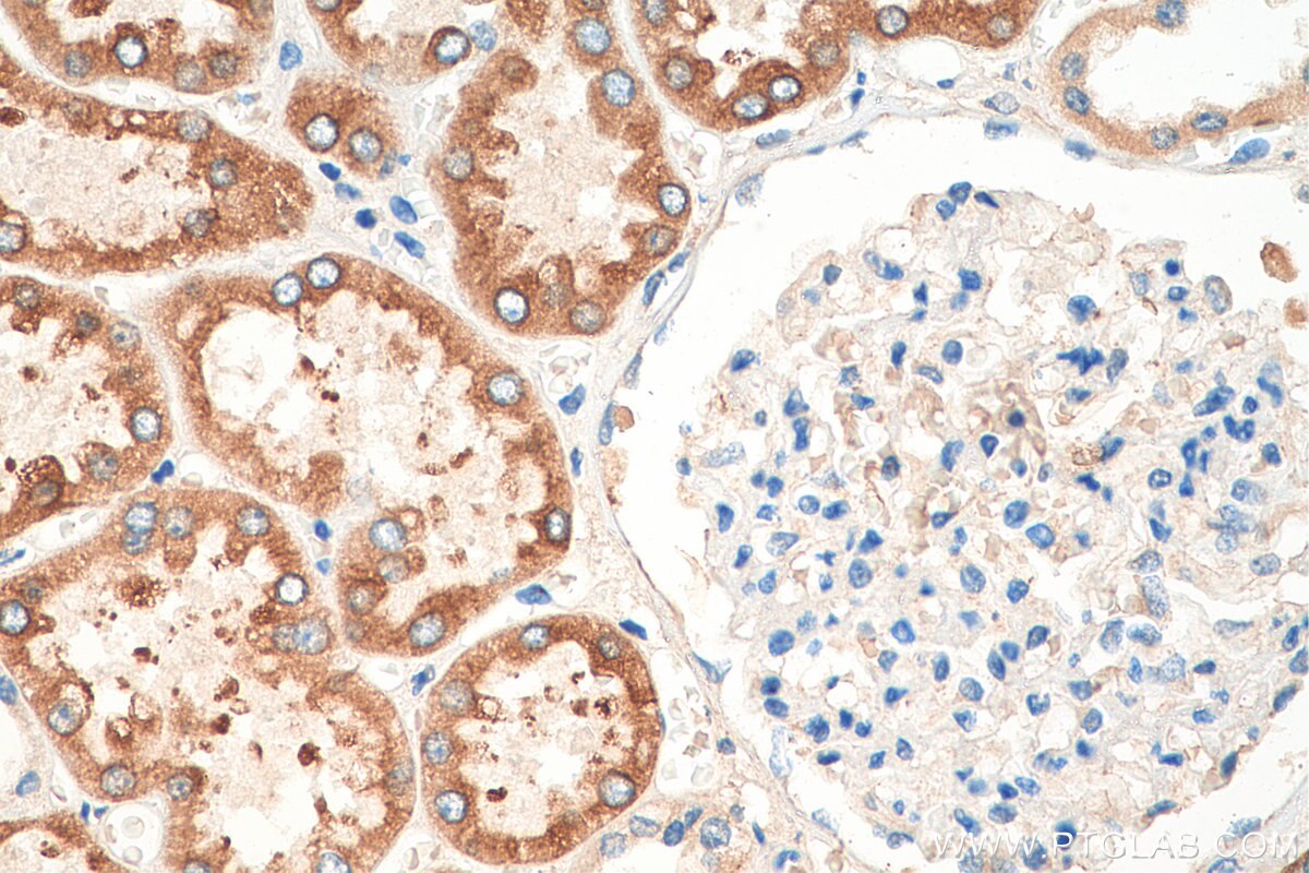 Immunohistochemistry (IHC) staining of human kidney tissue using FATP2 Polyclonal antibody (14048-1-AP)