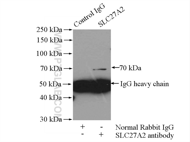 Immunoprecipitation (IP) experiment of HepG2 cells using FATP2 Polyclonal antibody (14048-1-AP)