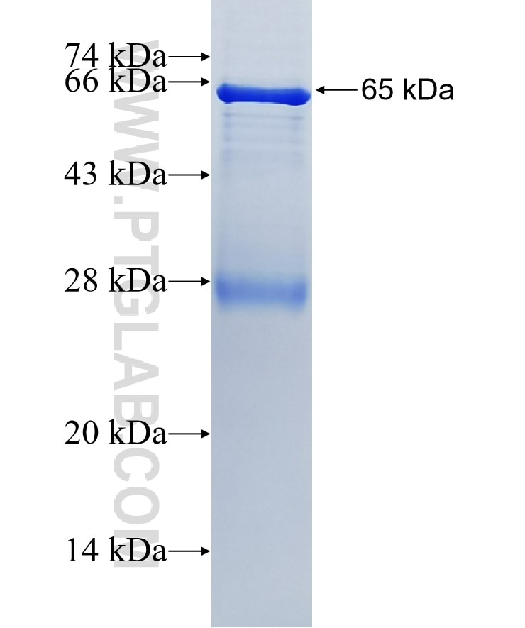 SLC27A2 fusion protein Ag5217 SDS-PAGE