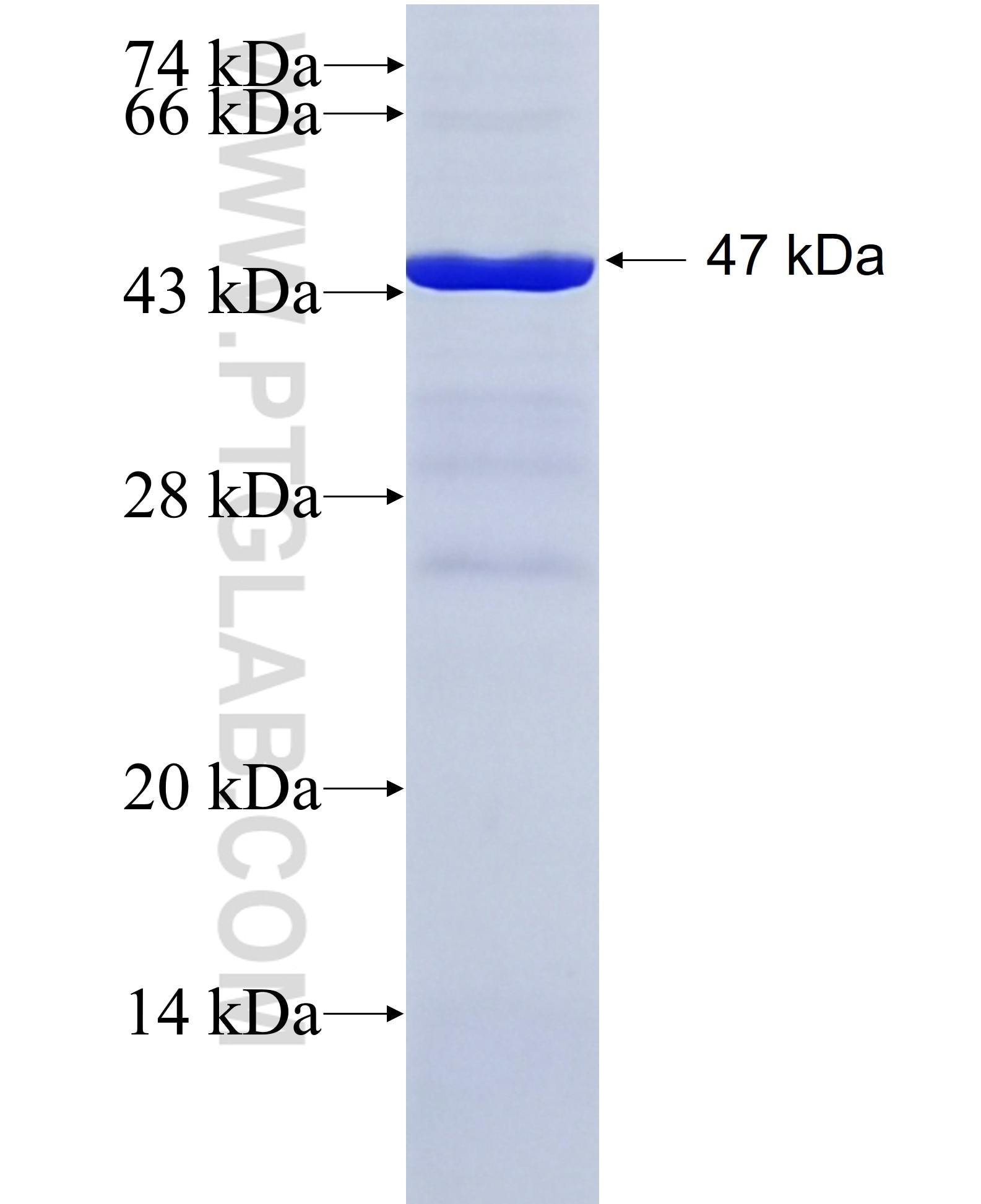 SLC27A2 fusion protein Ag5390 SDS-PAGE