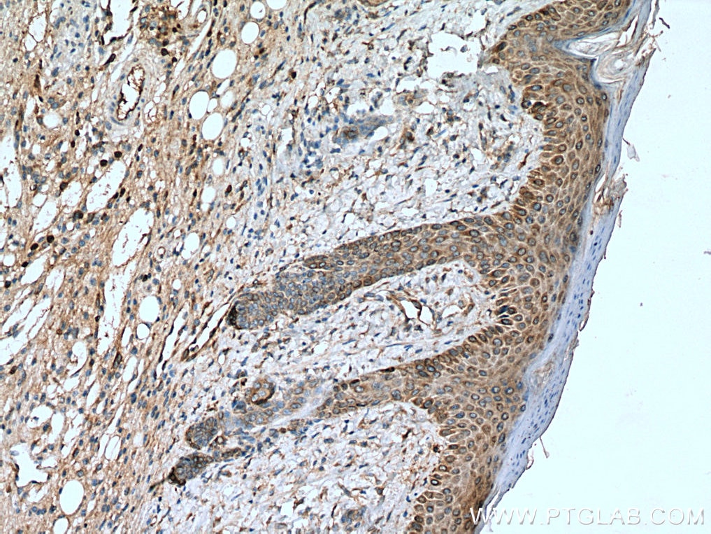 Immunohistochemistry (IHC) staining of mouse skin tissue using SLC27A3 Polyclonal antibody (12943-1-AP)