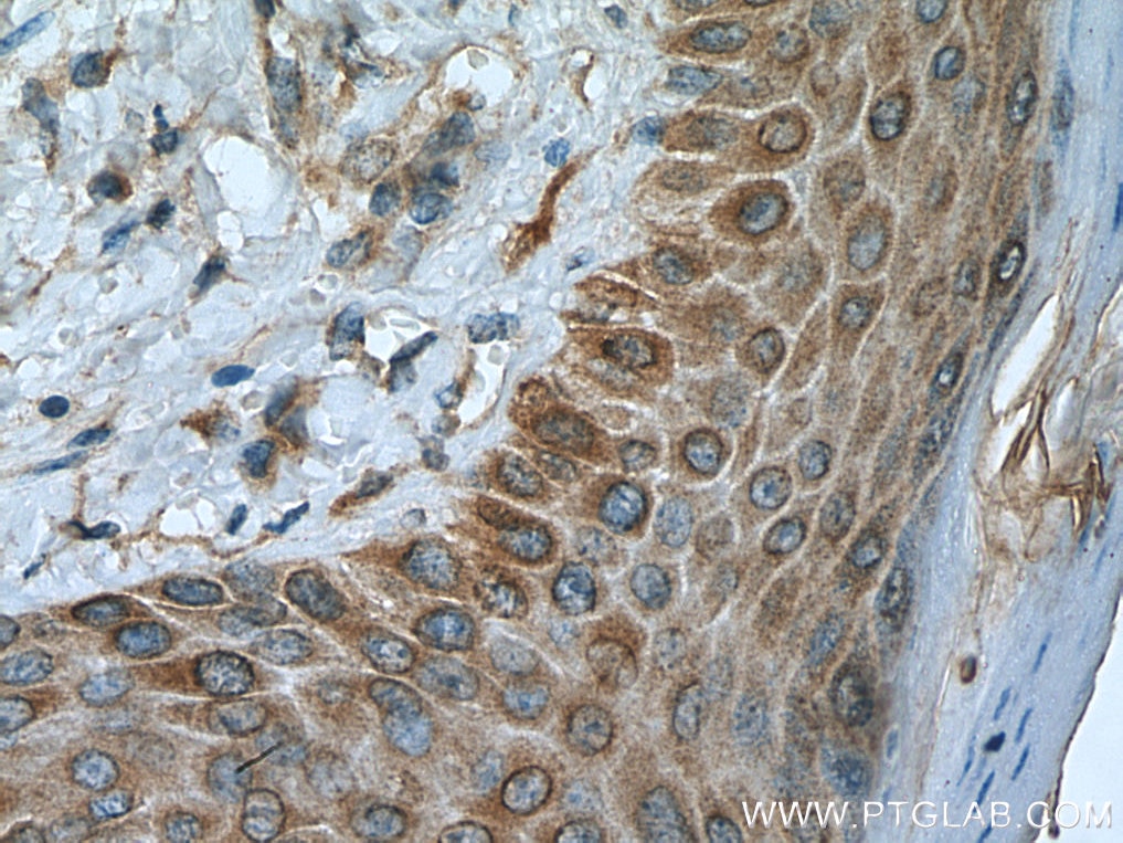 Immunohistochemistry (IHC) staining of mouse skin tissue using SLC27A3 Polyclonal antibody (12943-1-AP)