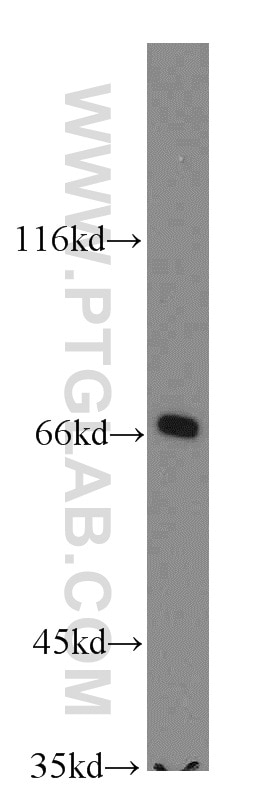 Western Blot (WB) analysis of mouse testis tissue using SLC27A3 Polyclonal antibody (12943-1-AP)