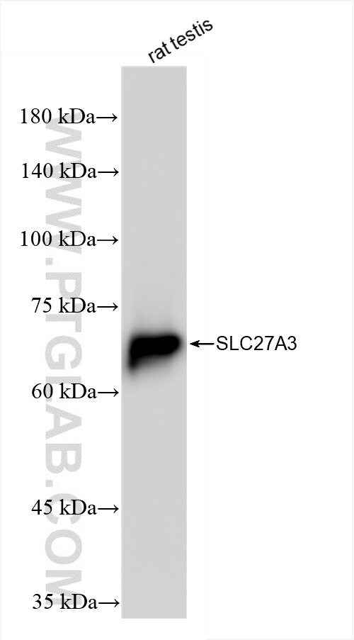 SLC27A3