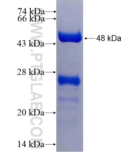 SLC27A3 fusion protein Ag4015 SDS-PAGE