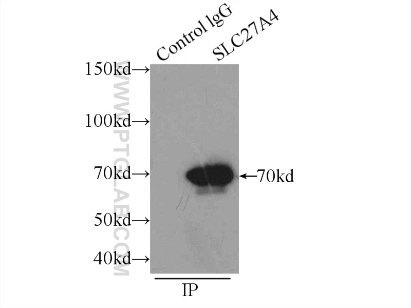 Immunoprecipitation (IP) experiment of HepG2 cells using FATP4 Polyclonal antibody (11013-1-AP)