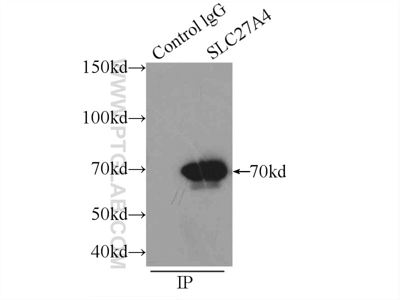 Immunoprecipitation (IP) experiment of HepG2 cells using FATP4 Polyclonal antibody (11013-1-AP)