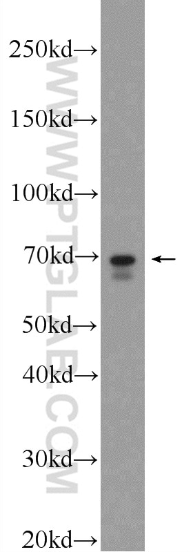 Western Blot (WB) analysis of SMMC-7721 cells using FATP4 Polyclonal antibody (11013-1-AP)