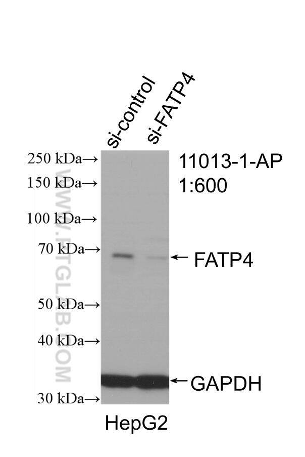 Western Blot (WB) analysis of HepG2 cells using FATP4 Polyclonal antibody (11013-1-AP)