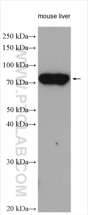 Western Blot (WB) analysis of various lysates using FATP4 Polyclonal antibody (11013-1-AP)