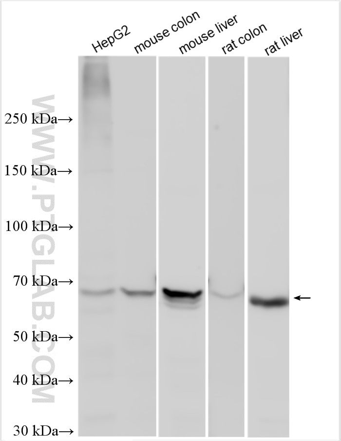 Western Blot (WB) analysis of various lysates using FATP4 Polyclonal antibody (11013-1-AP)