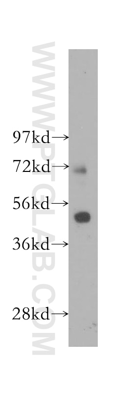 Western Blot (WB) analysis of human colon tissue using FATP4 Polyclonal antibody (11013-1-AP)