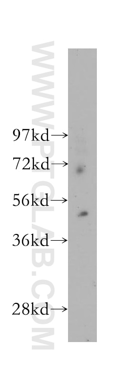 Western Blot (WB) analysis of human heart tissue using FATP4 Polyclonal antibody (11013-1-AP)