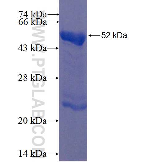 SLC27A4 fusion protein Ag1490 SDS-PAGE