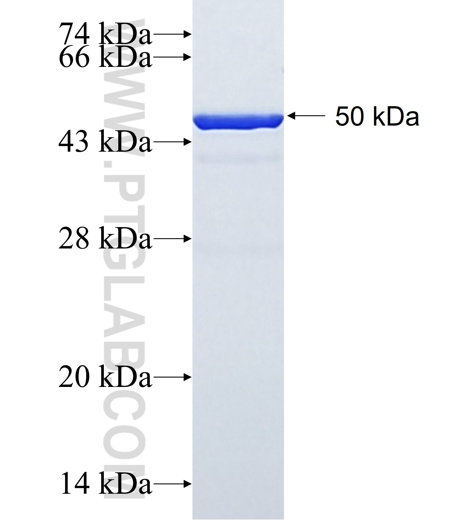 SLC27A4 fusion protein Ag1490 SDS-PAGE