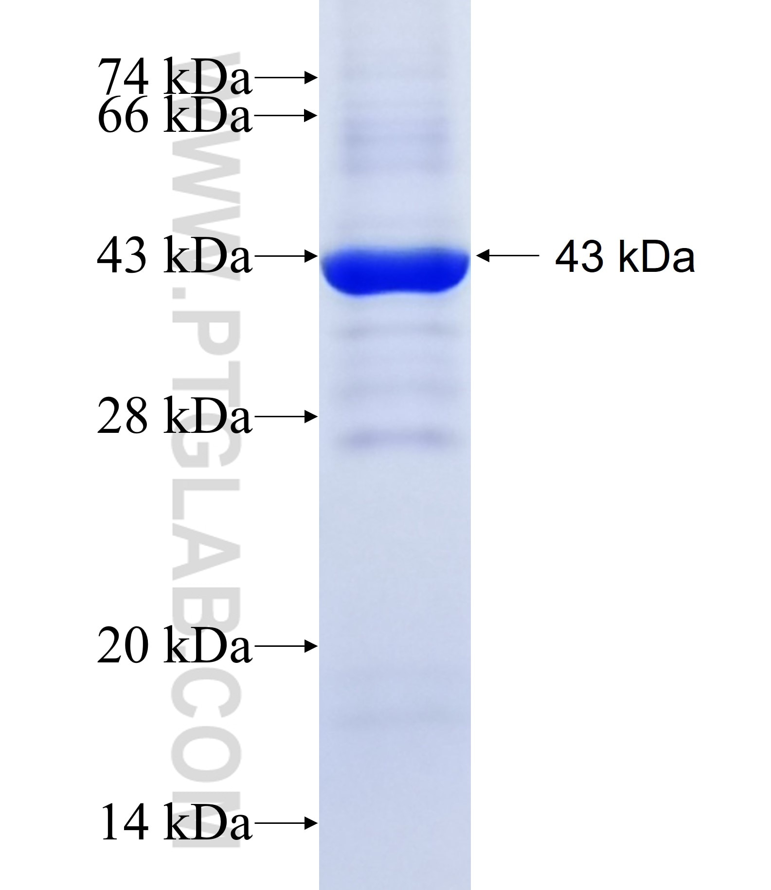 SLC27A5 fusion protein Ag18446 SDS-PAGE