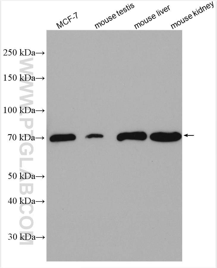 Western Blot (WB) analysis of various lysates using SLC27A6 Polyclonal antibody (14197-1-AP)
