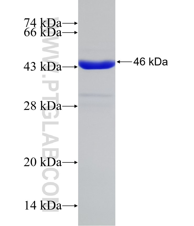 SLC27A6 fusion protein Ag32179 SDS-PAGE