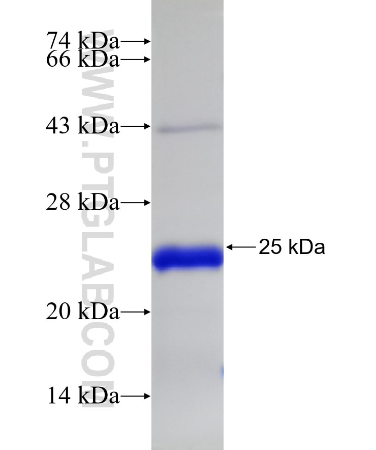 SLC27A6 fusion protein Ag32185 SDS-PAGE SLC27A6 fusion protein Ag32185 SDS-PAGE