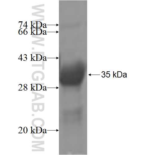 SLC27A6 fusion protein Ag5400 SDS-PAGE
