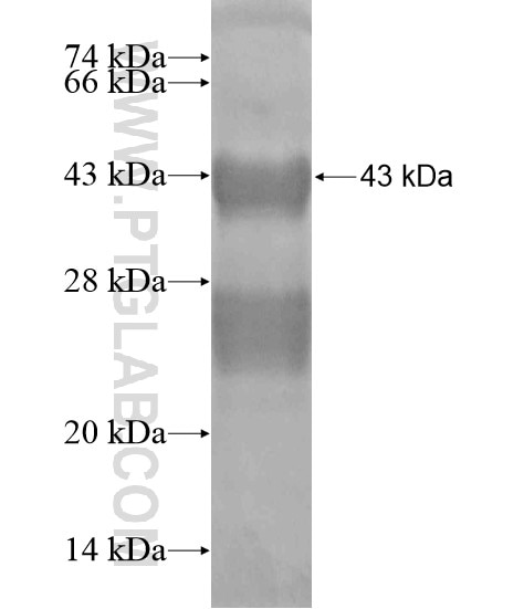 SLC28A1 fusion protein Ag20116 SDS-PAGE