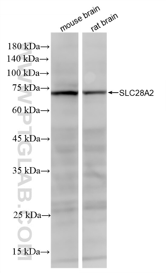Western Blot (WB) analysis of various lysates using SLC28A2 Recombinant monoclonal antibody (87846-1-RR)