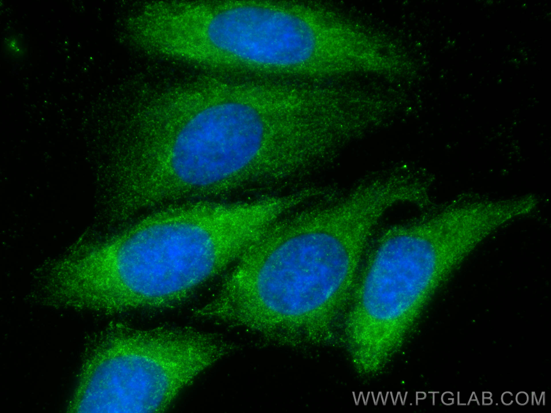 Immunofluorescence (IF) / fluorescent staining of HepG2 cells using SLC28A3 Polyclonal antibody (18182-1-AP)