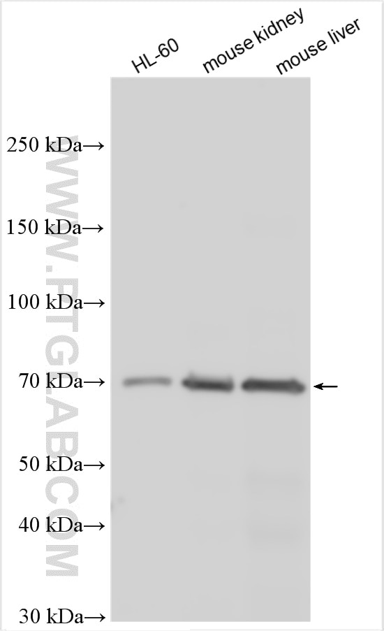Western Blot (WB) analysis of various lysates using SLC28A3 Polyclonal antibody (18182-1-AP)