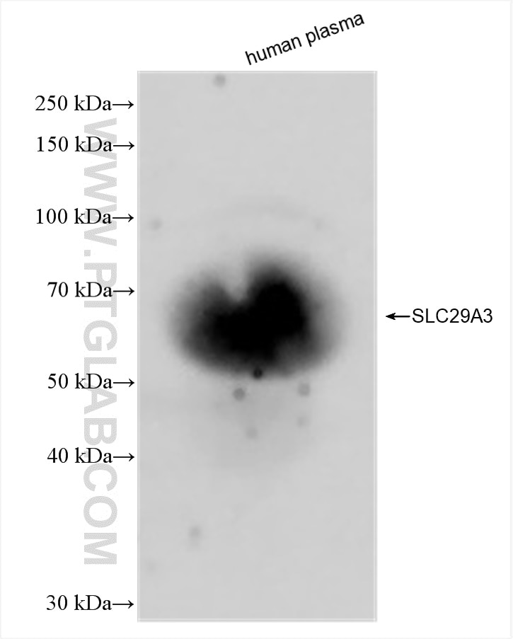 Western Blot (WB) analysis of human plasma using SLC29A3 Recombinant antibody (83036-1-RR)