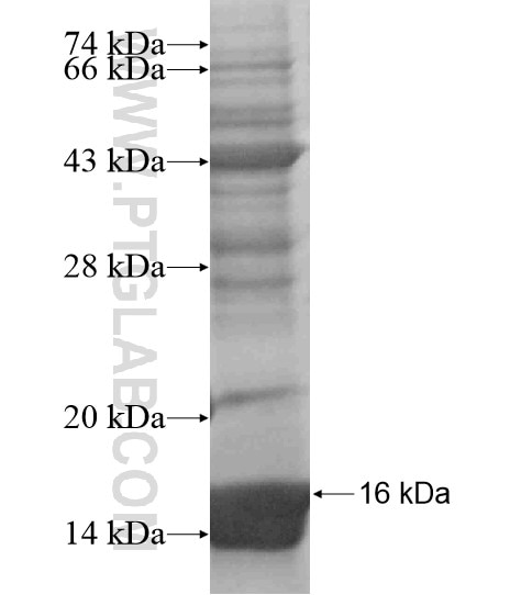 SLC29A3 fusion protein Ag18662 SDS-PAGE