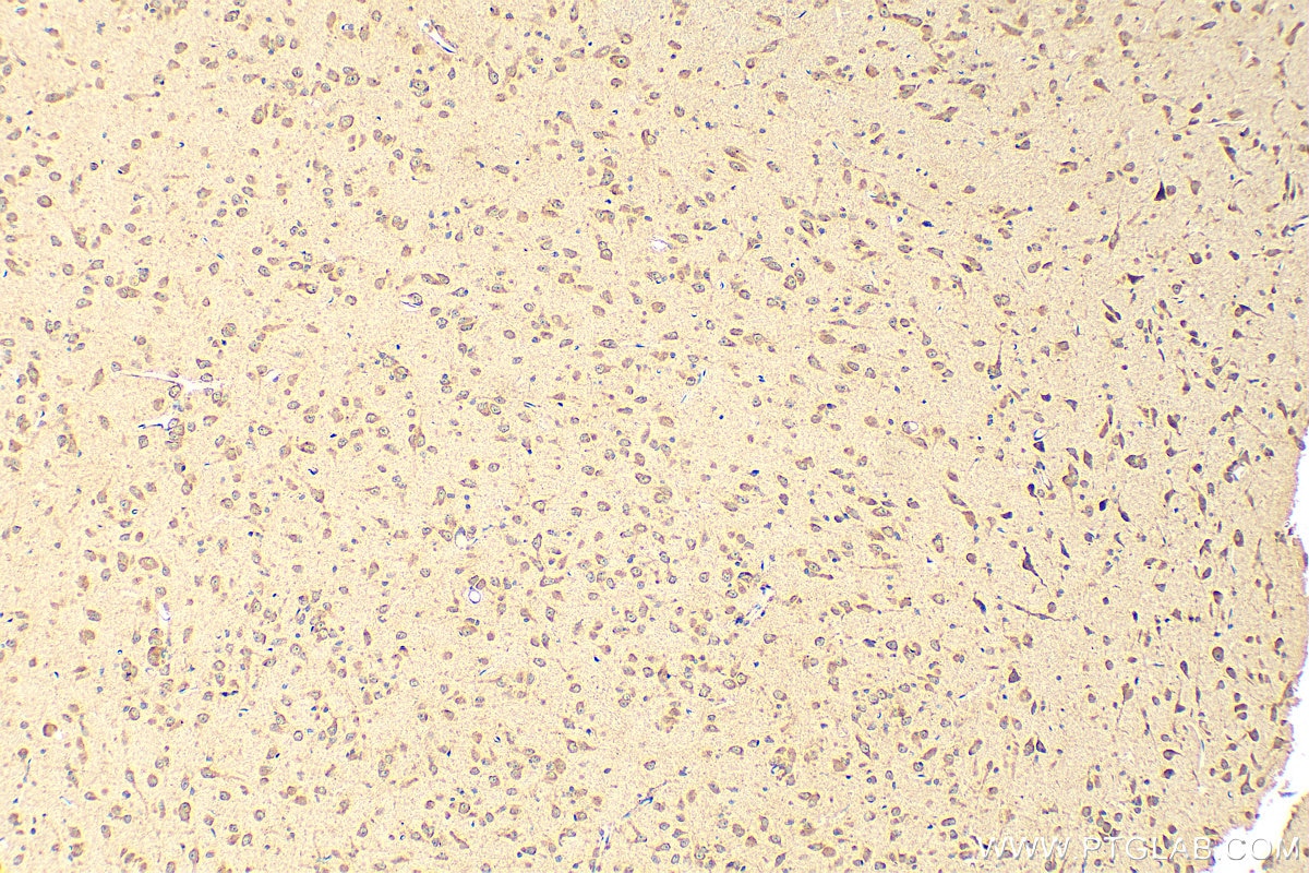 Immunohistochemistry (IHC) staining of rat brain tissue using SLC29A4 Polyclonal antibody (26423-1-AP)