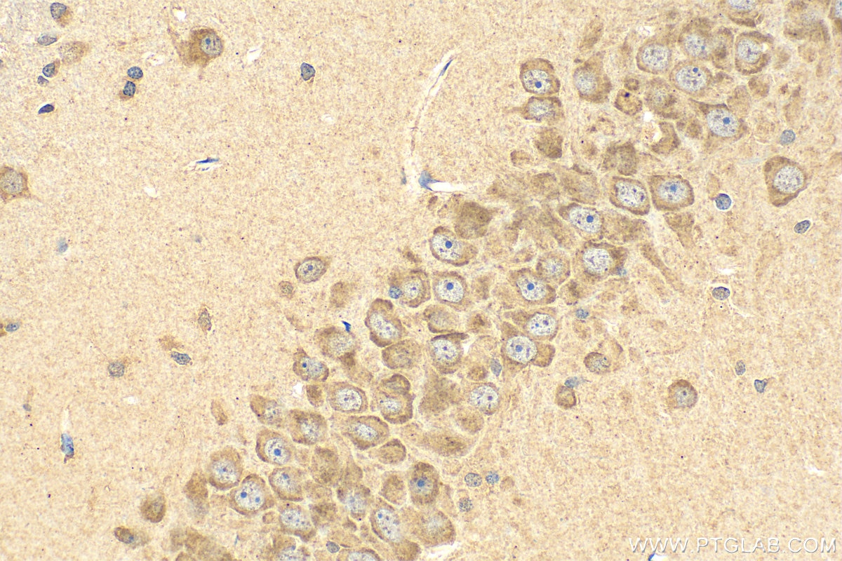 Immunohistochemistry (IHC) staining of rat brain tissue using SLC29A4 Polyclonal antibody (26423-1-AP)