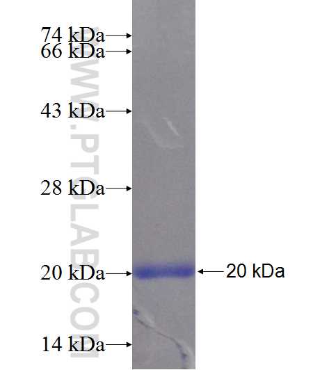 SLC29A4 fusion protein Ag24869 SDS-PAGE