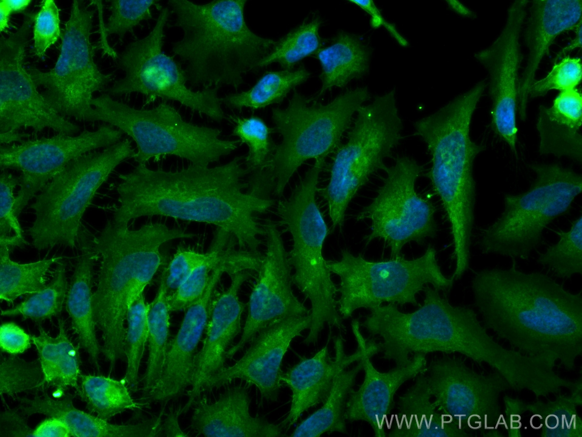 Immunofluorescence (IF) / fluorescent staining of HeLa cells using GLUT1 Polyclonal antibody (21829-1-AP)