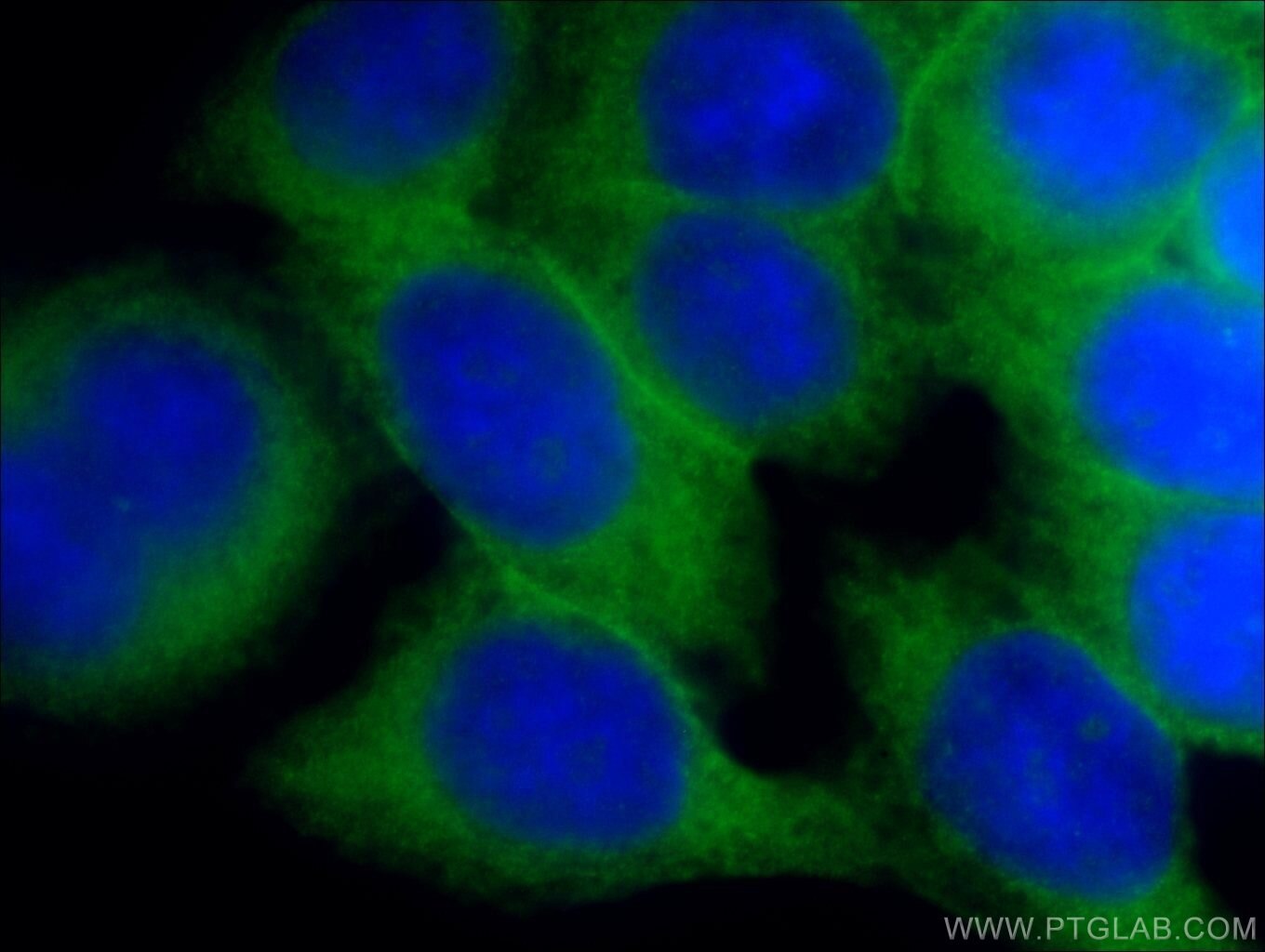 IF analysis of HeLa cells using SLC2A1,GLUT1 antibody (21829- 1-AP) at a dilution of 1:50 and Alexa Fluor 488-congugated AffiniPure Goat Anti-Rabbit IgG(H+L)