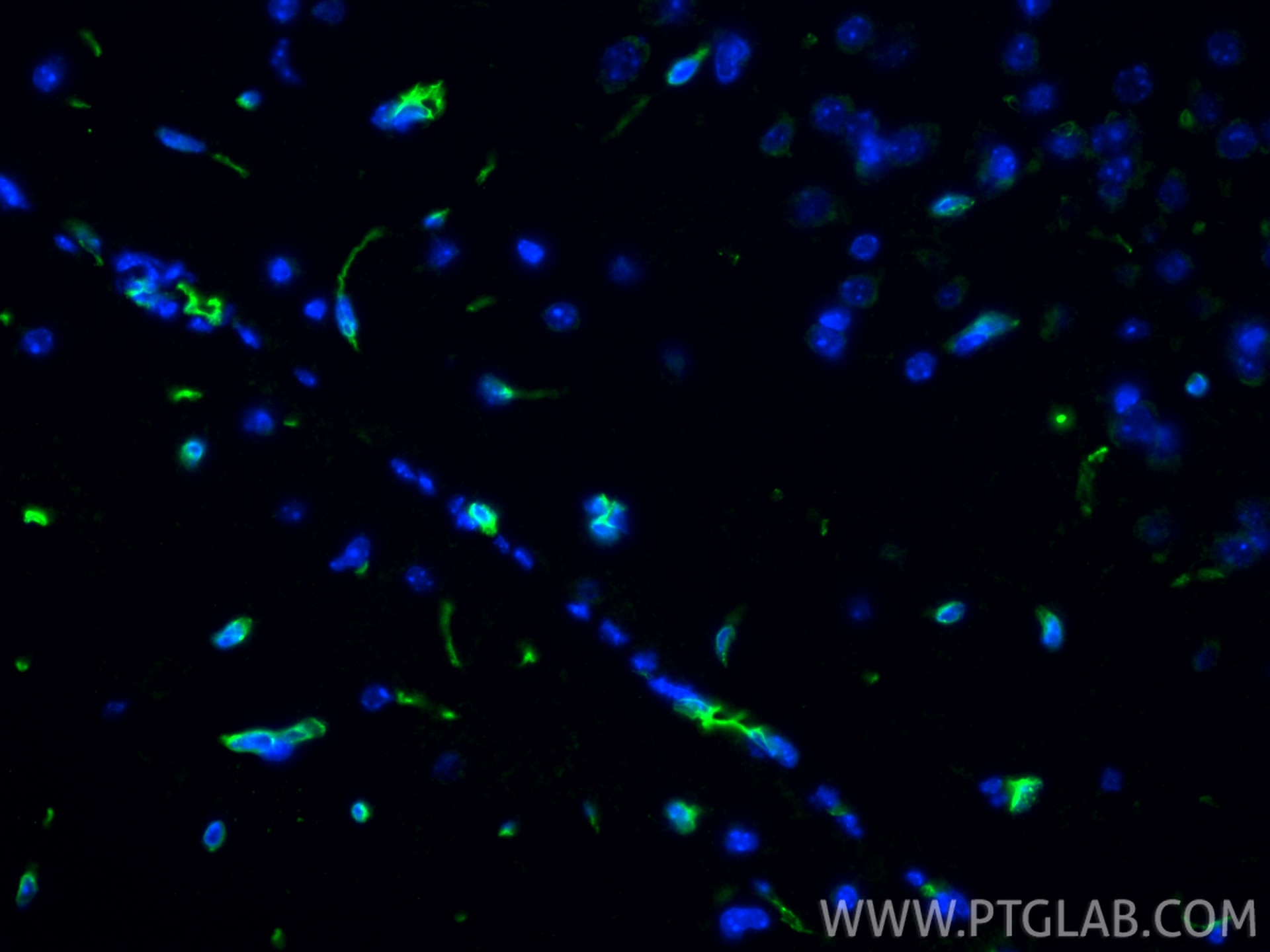 Immunofluorescence (IF) / fluorescent staining of mouse brain tissue using GLUT1 Polyclonal antibody (21829-1-AP)