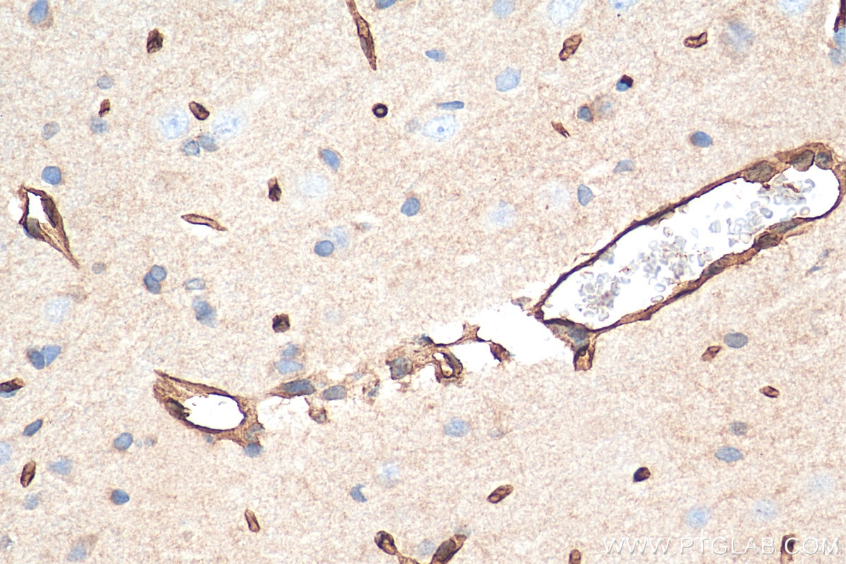 Immunohistochemistry (IHC) staining of rat brain tissue using GLUT1 Polyclonal antibody (21829-1-AP)