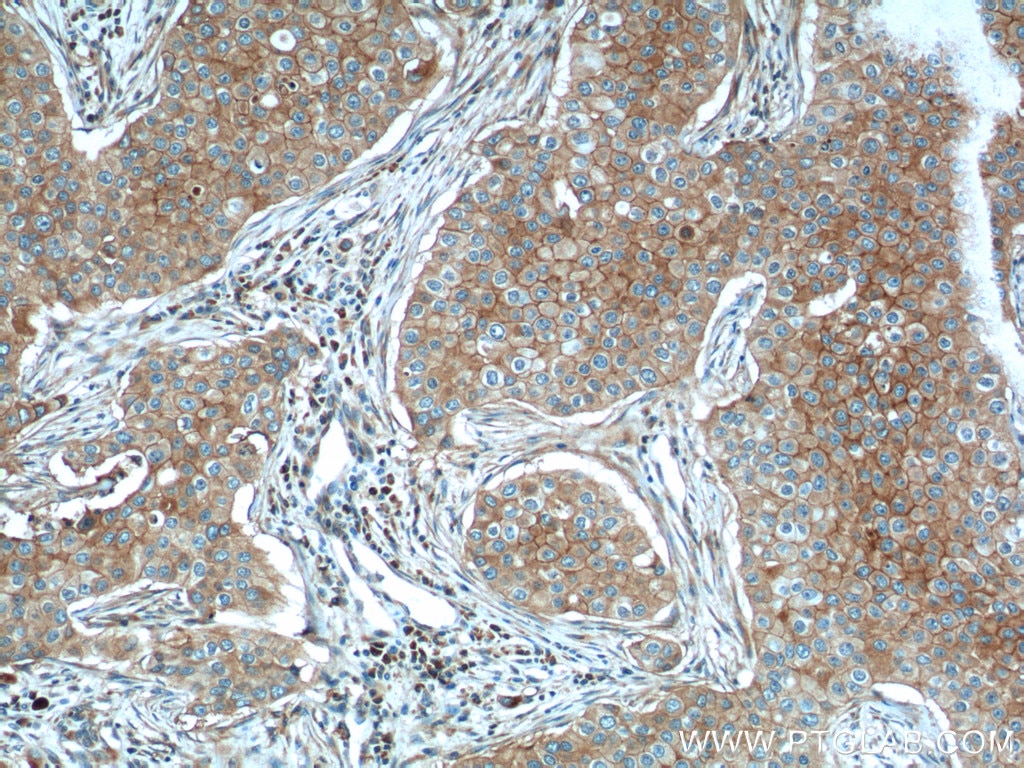 GLUT1 Polyclonal antibody