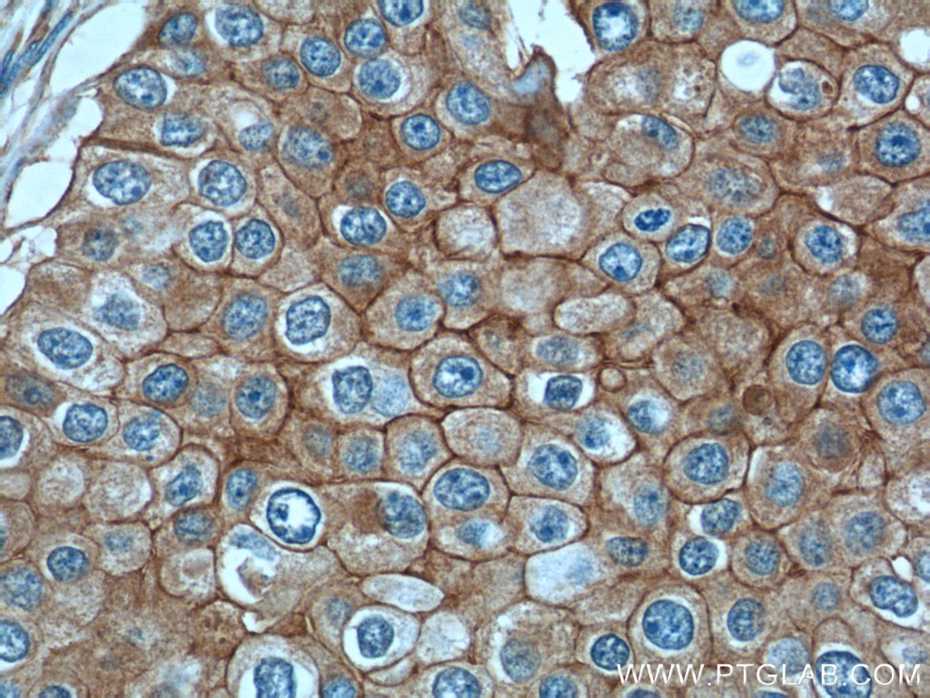 GLUT1 Polyclonal antibody