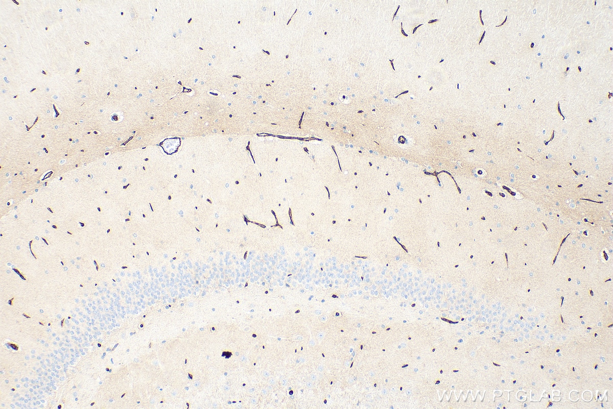 Immunohistochemistry (IHC) staining of rat brain tissue using GLUT1 Polyclonal antibody (21829-1-AP)