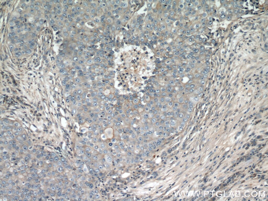 GLUT1 Polyclonal antibody