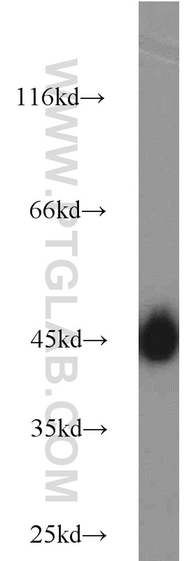 GLUT1 Polyclonal antibody