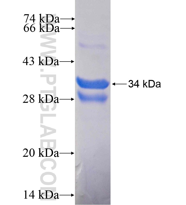 SLC2A1,GLUT1 fusion protein Ag16282 SDS-PAGE